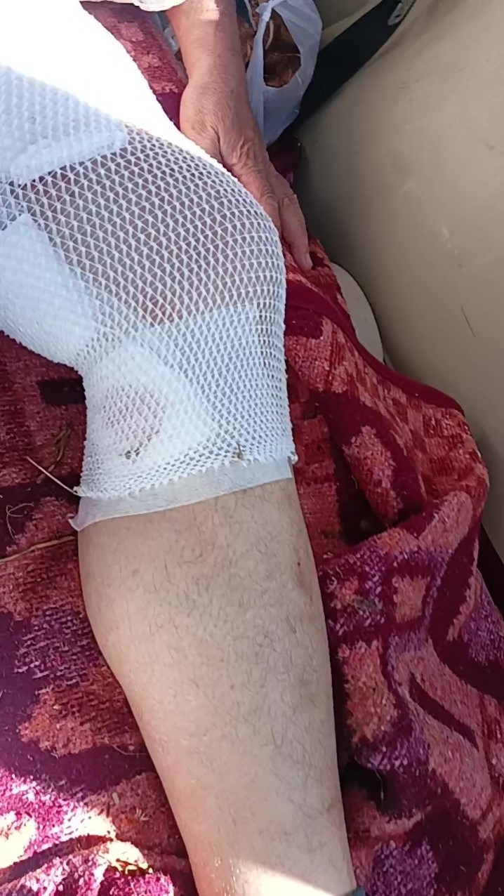 Aslanın saldırısına uğrayan çiftçi o anları anlattı: "Biraz güçlü olmasaydım, şu anda bende belki de yoktum"
