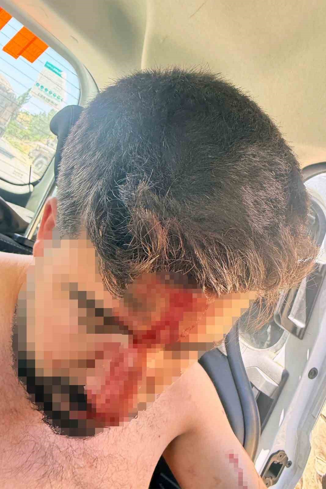 Şırnak’ta Dicle Elektrik saha ekibine saldırı: 1 kişi yaralandı