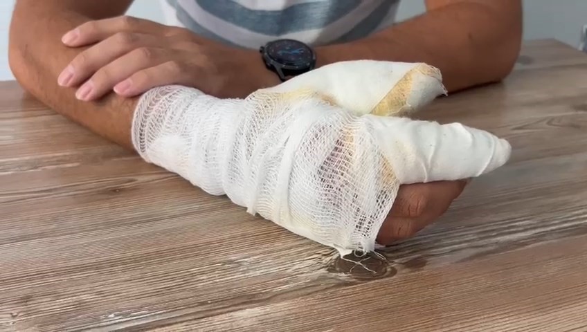 Bing&ouml;l&rsquo;de cep telefonu bataryası bir anda patladı: O anlar g&uuml;venlik kamerasında
