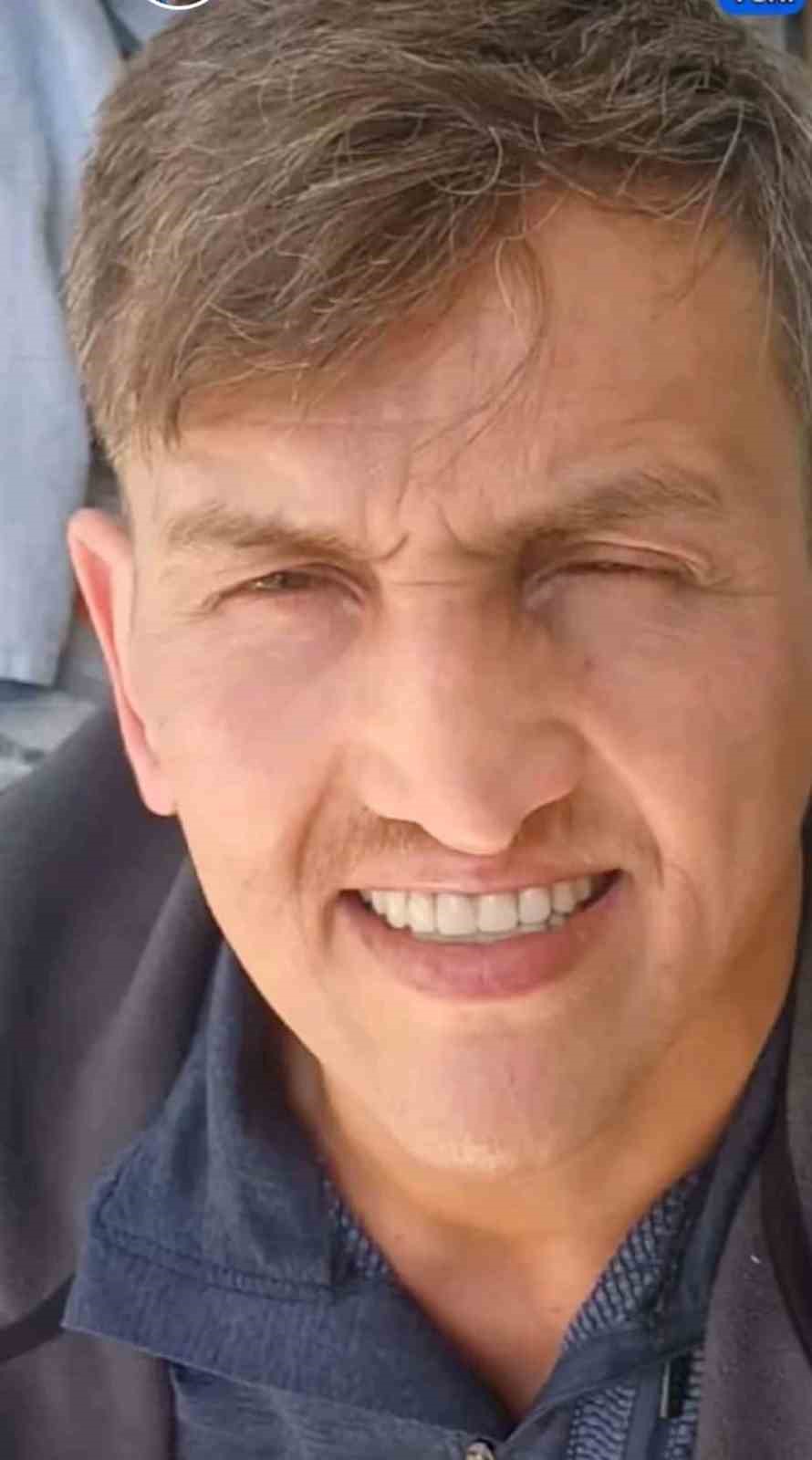 İstanbul’da burun estetiği ameliyatının ardından hayatını kaybetti