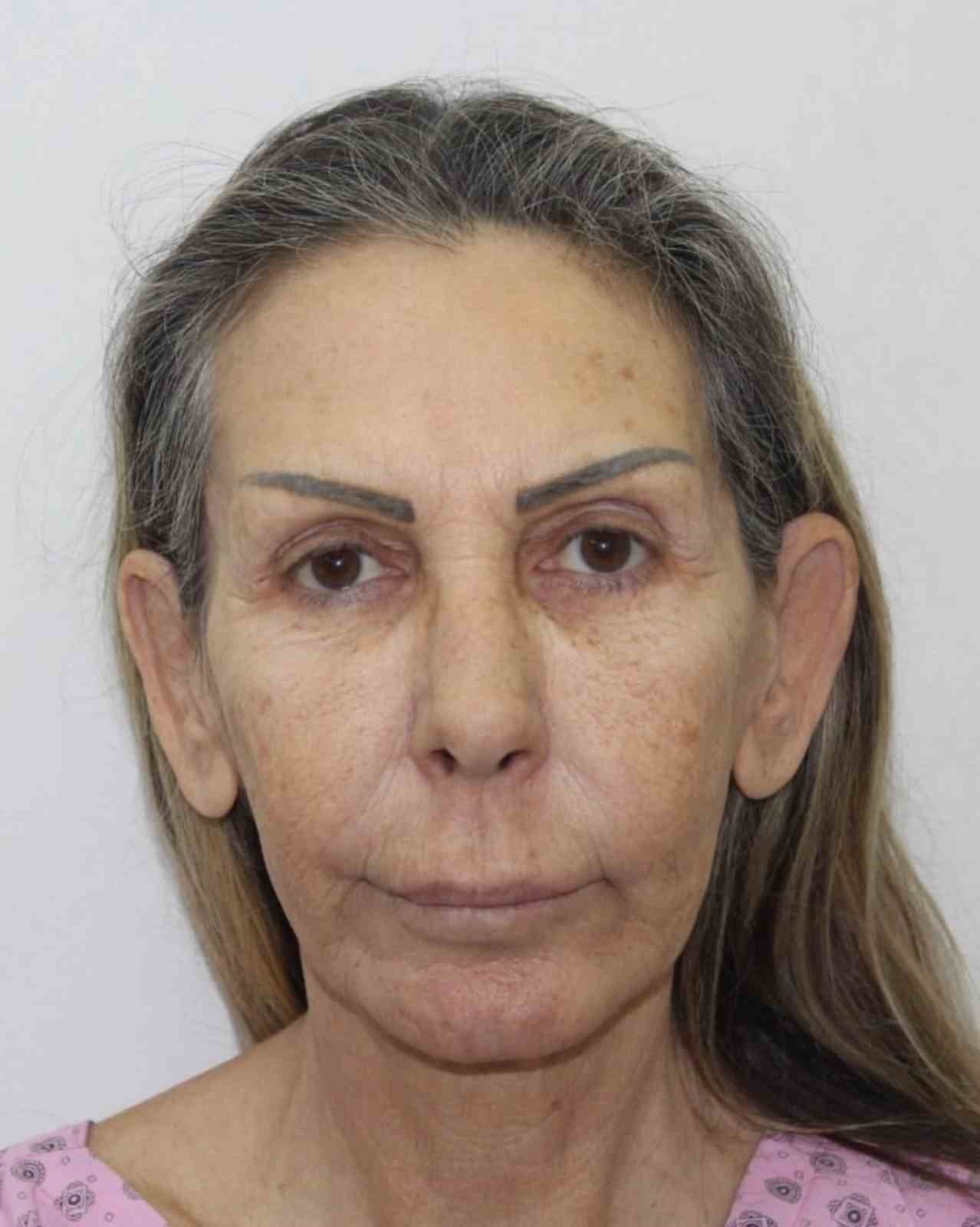 Petek Dinçöz’den sonra annesi de estetik ameliyat oldu: Son hali şaşırttı
