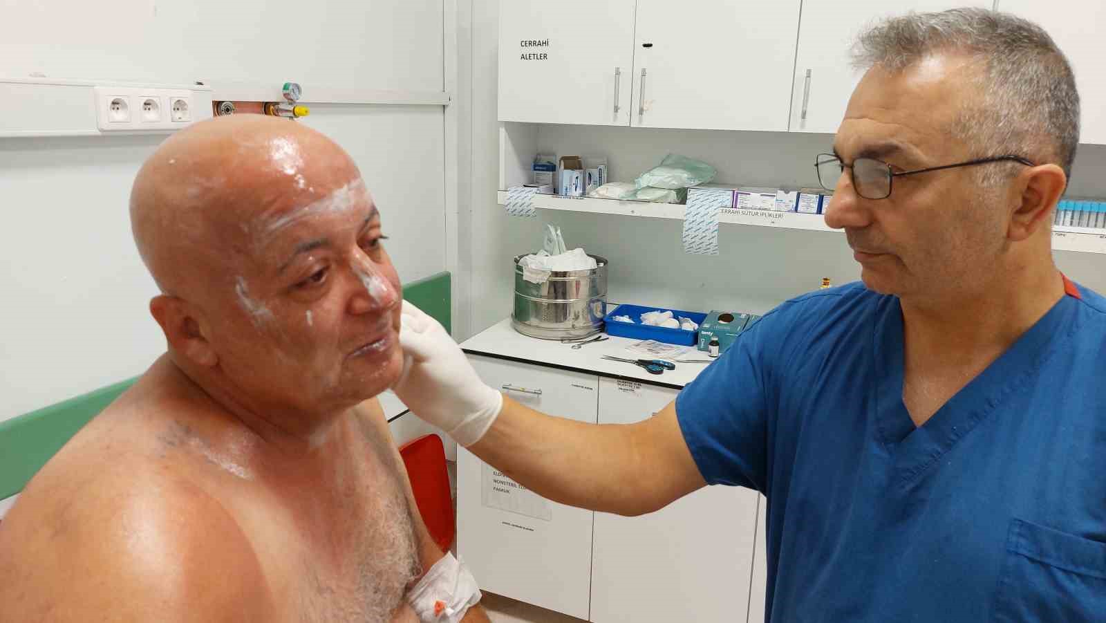 Tır s&uuml;r&uuml;c&uuml;s&uuml; t&uuml;pgaz parlaması sonucu yanarak hastanelik oldu
