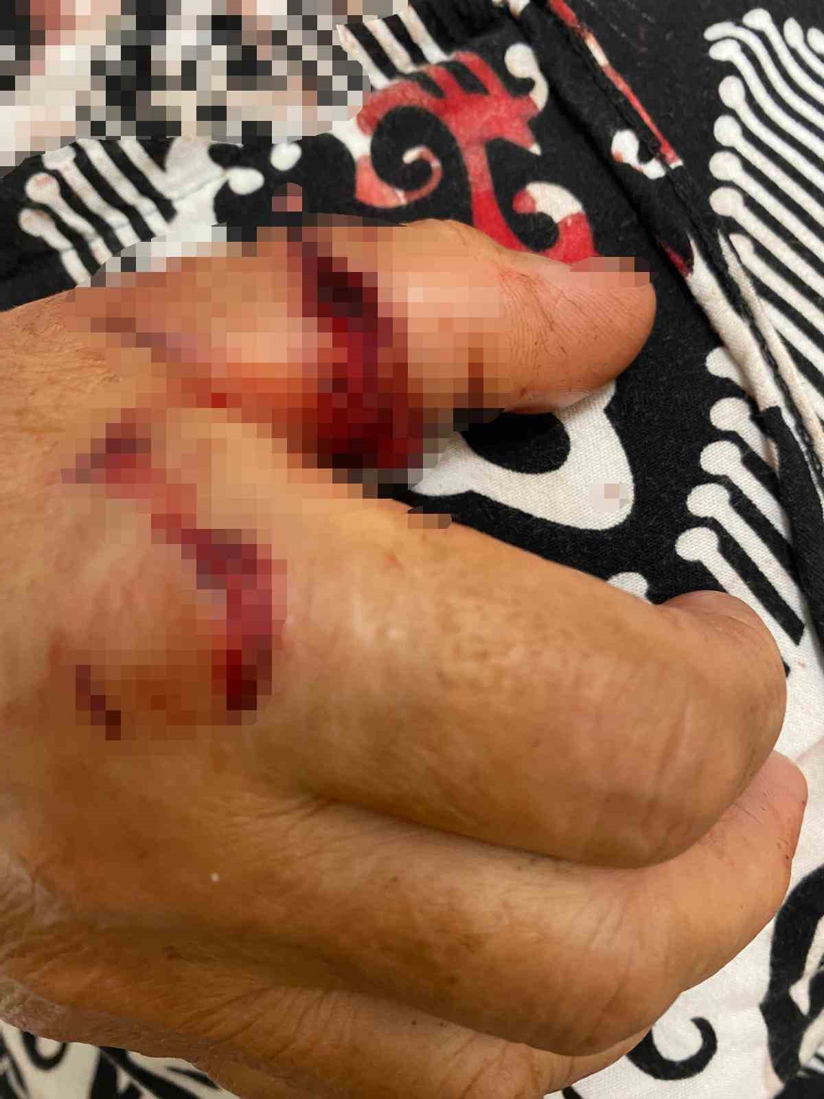 Abdest almak için bahçeye çıkan kadına köpekler saldırdı