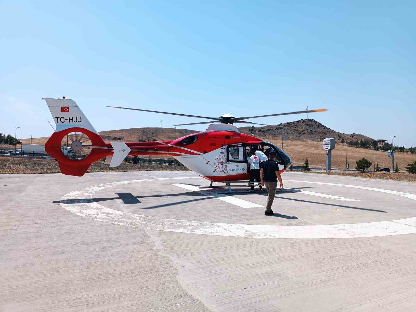 Elini kıyma makinesine kaptıran çocuk hava ambulansıyla Ankara’ya sevk edildi