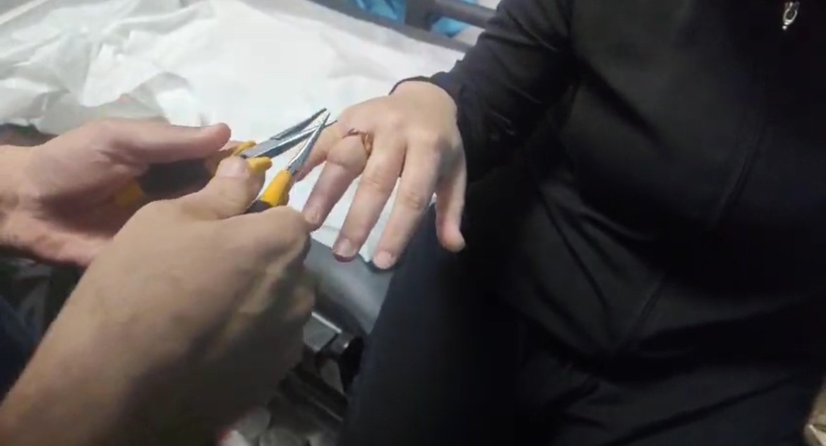 Kadının parmağına sıkışan y&uuml;z&uuml;k, itfaiye ekibince hastanede &ccedil;ıkarıldı
