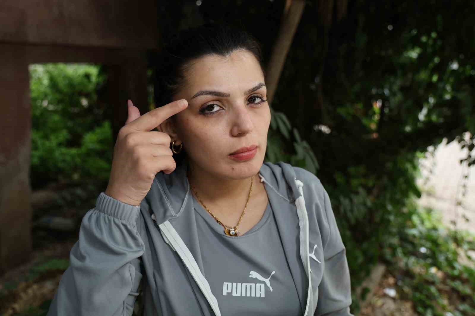 Cezaevinden firar etti, yüzünü bıçakladığı kadına ’Affına sığınıyorum’ mesajı attı