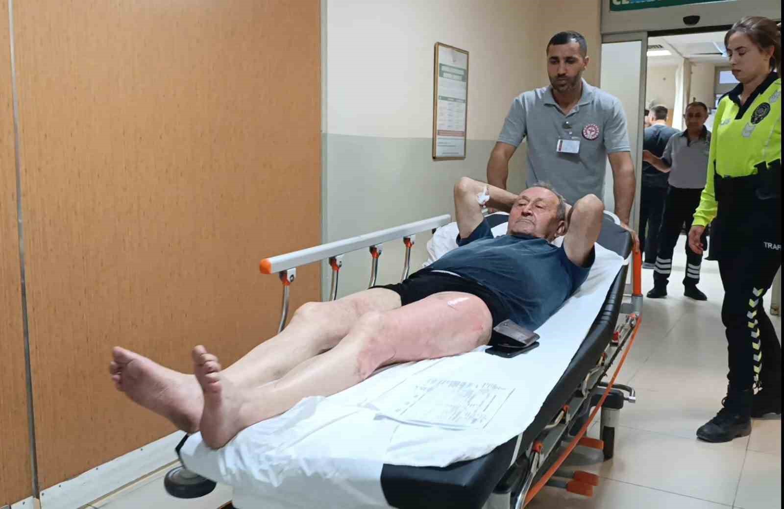 &Uuml;zerine kaynar su d&ouml;k&uuml;len adam hastanelik oldu
