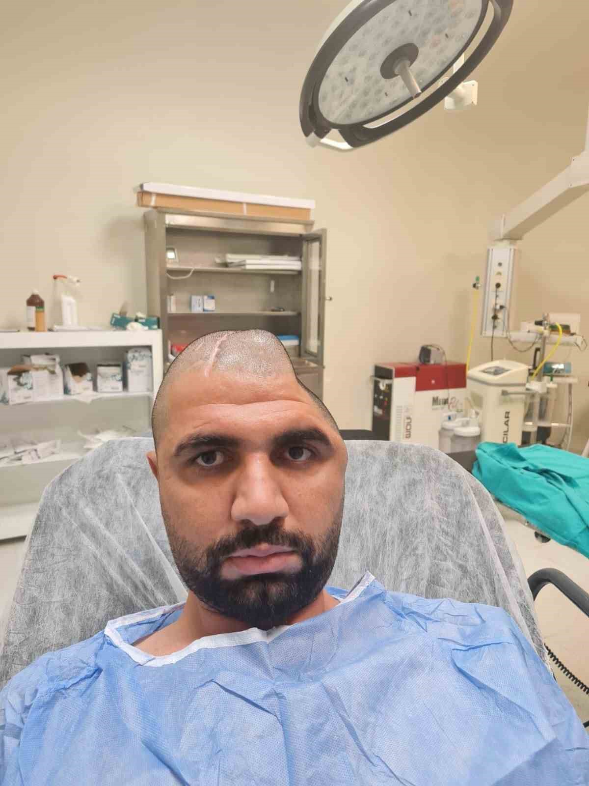 Nusaybin’de 3 boyutlu yazıcıyla kraniyoplasti ameliyatı başarıyla gerçekleştirildi