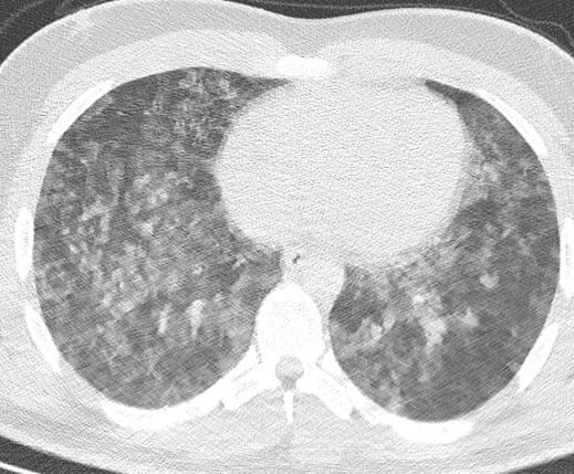 Samsun&rsquo;daki boğulma vakaları tırmanışta: 4 ilden gelen tatilcilere uyarı
