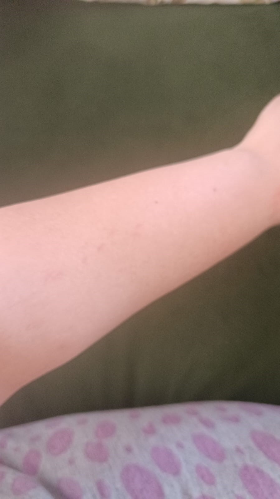 Şiddete ve tacize uğradığını iddia eden Dilek Yiğiter Tunçdoğan: "Bu adam dışarda elini kolunu sallayarak geziyor"