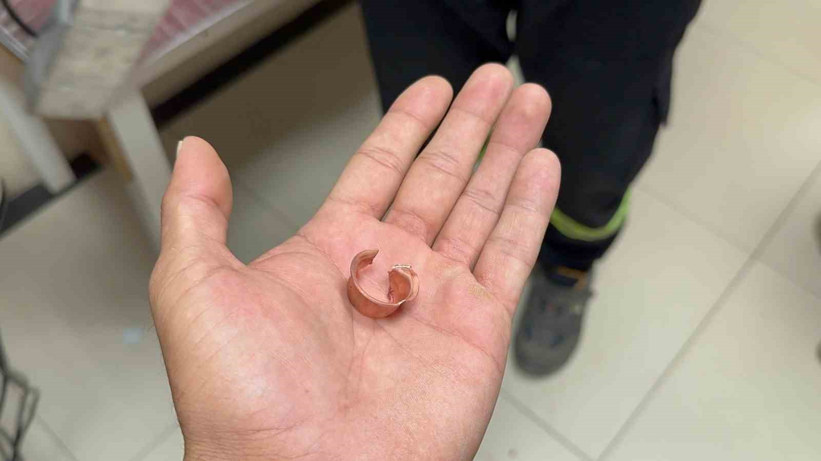 Çocuğun parmağına sıkışan metal cisim, kesilerek çıkarıldı 