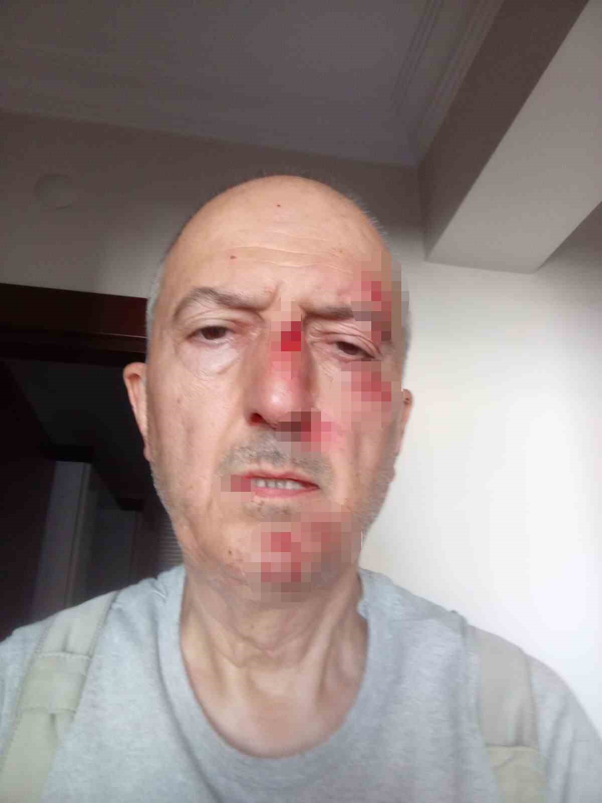 Önce icra yoluyla evinden tahliye edildi, ardından darp edildi