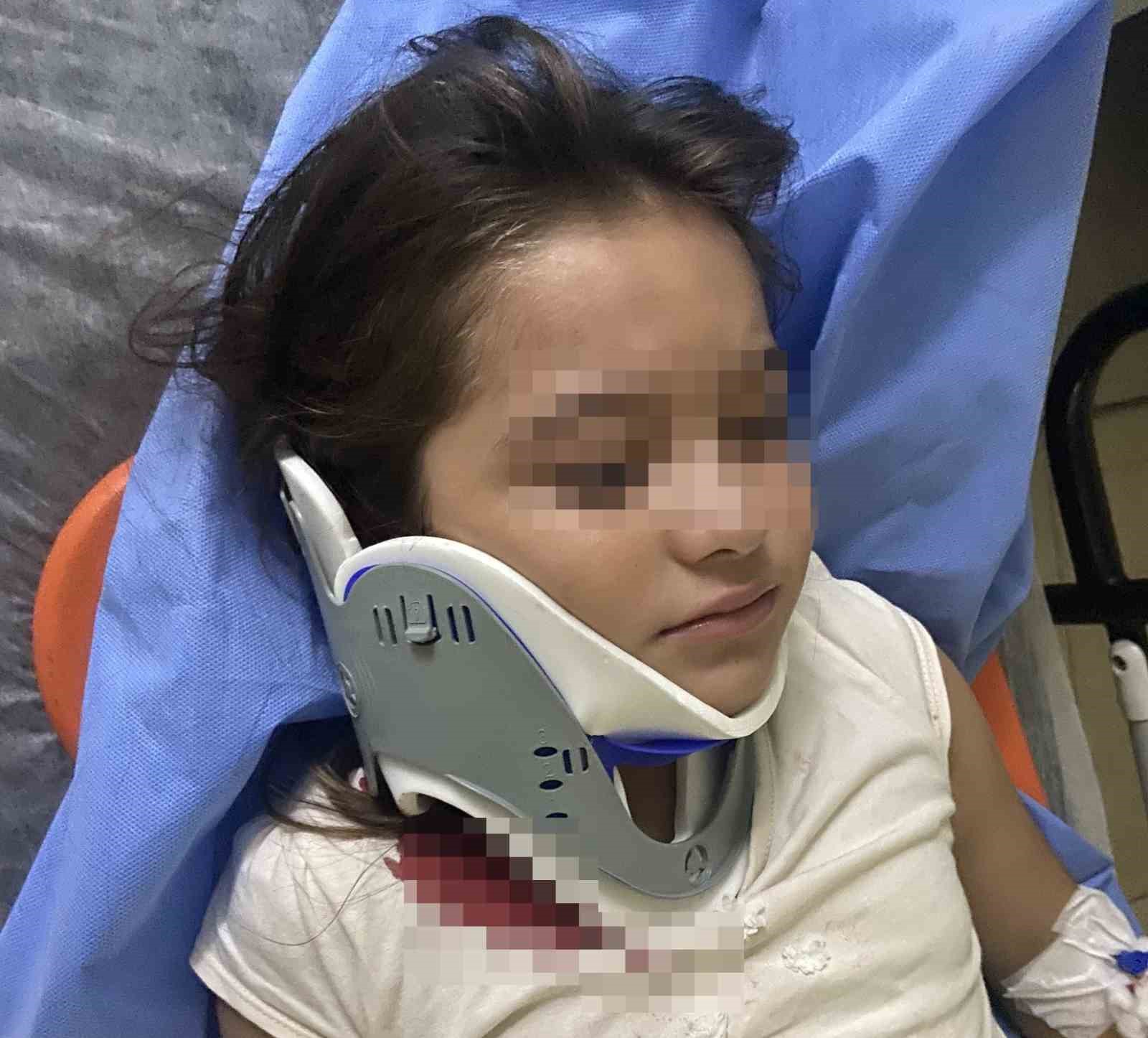 Ordu’da ters şeritten gelen scooter, 8 yaşındaki çocuğa çarptı