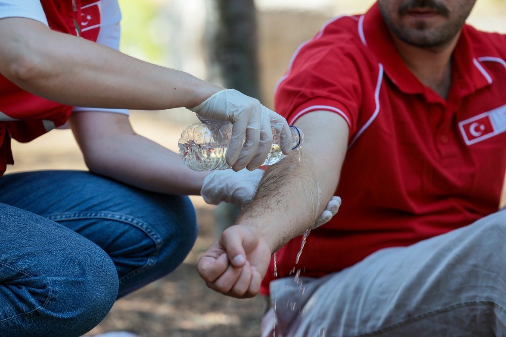 Orman yangınlarında hayati m&uuml;dahale: "Kızılay&rsquo;dan ilk yardım rehberi"
