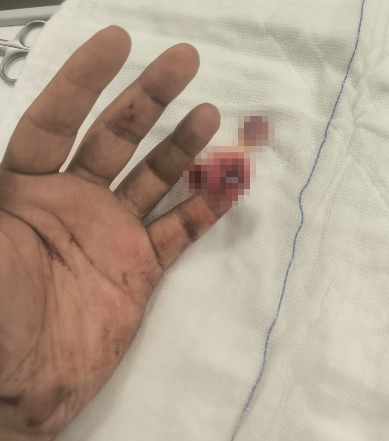 Uyuşturucuyla yakalanan ş&uuml;pheli, polisin parmağını kopardı
