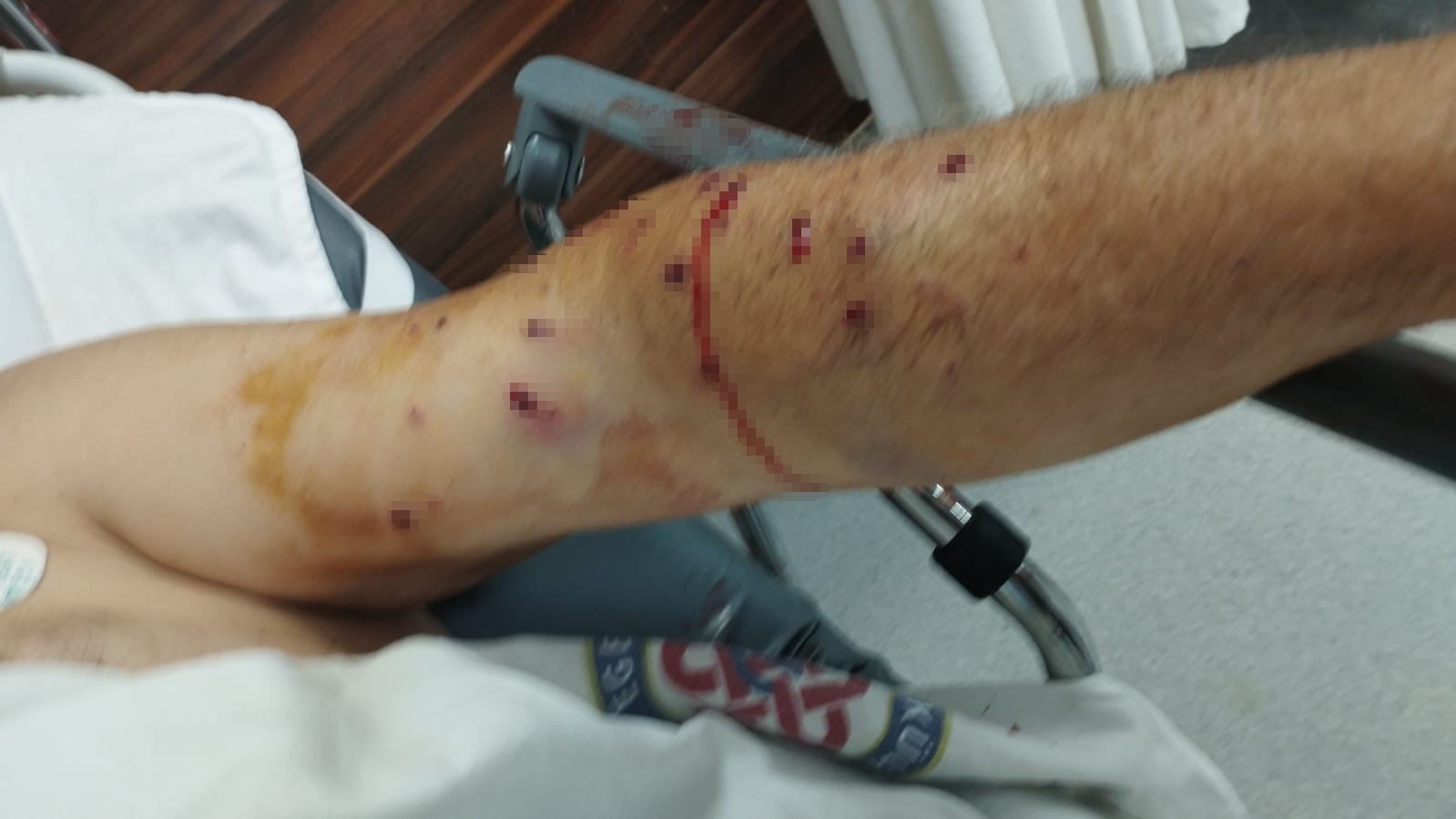 İzmir’de tır sahibi 180 liralık kantar ücreti için çalışanı vurdu