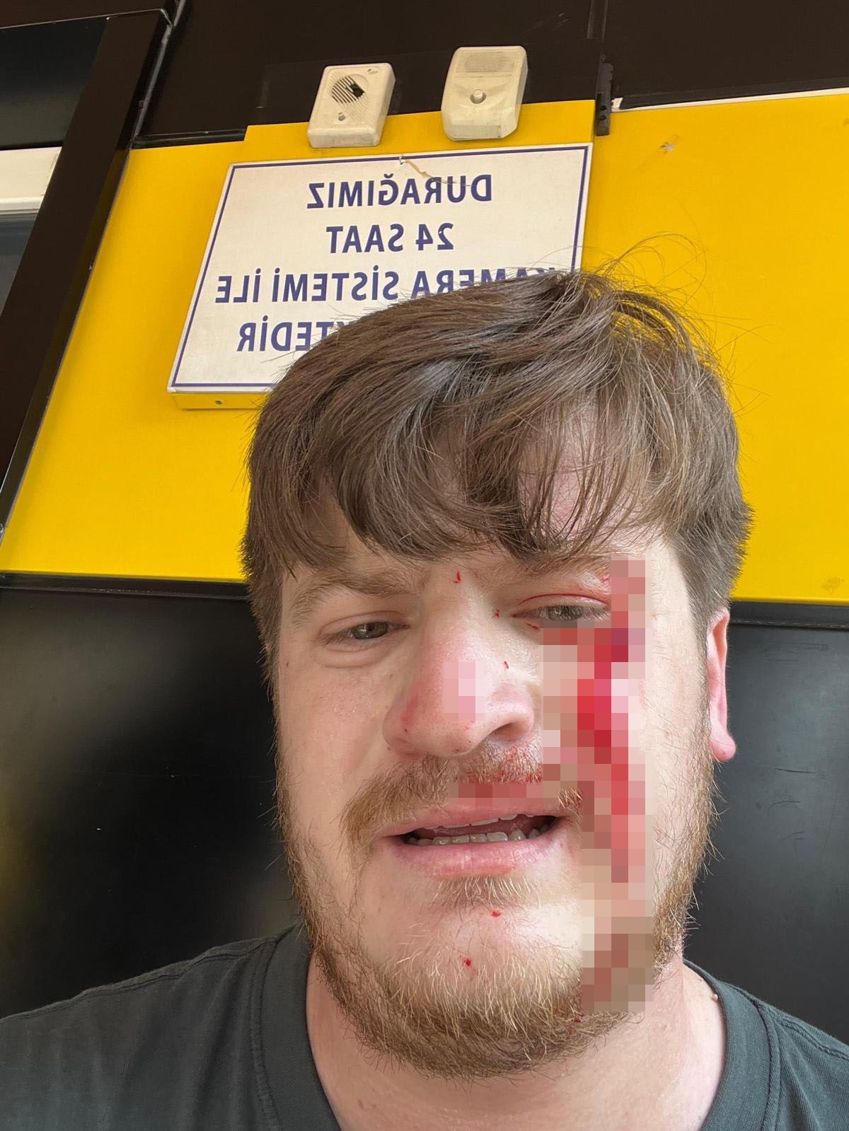 Meslektaşının ofisinde saldırıya uğrayan avukat, yaşadıklarını anlattı
