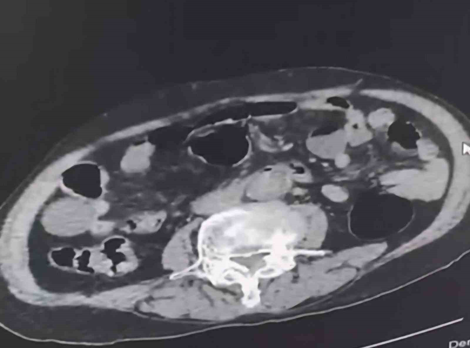 Cinsel organında Denizli’ye uyuşturucu sokmak isteyen yabancı uyruklu şahıs tutuklandı