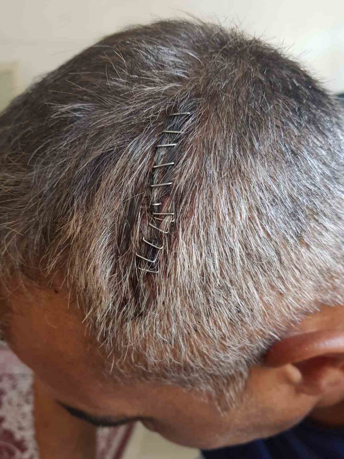 Eğlence merkezi &ccedil;ıkışında &ouml;ld&uuml;resiye dayak
