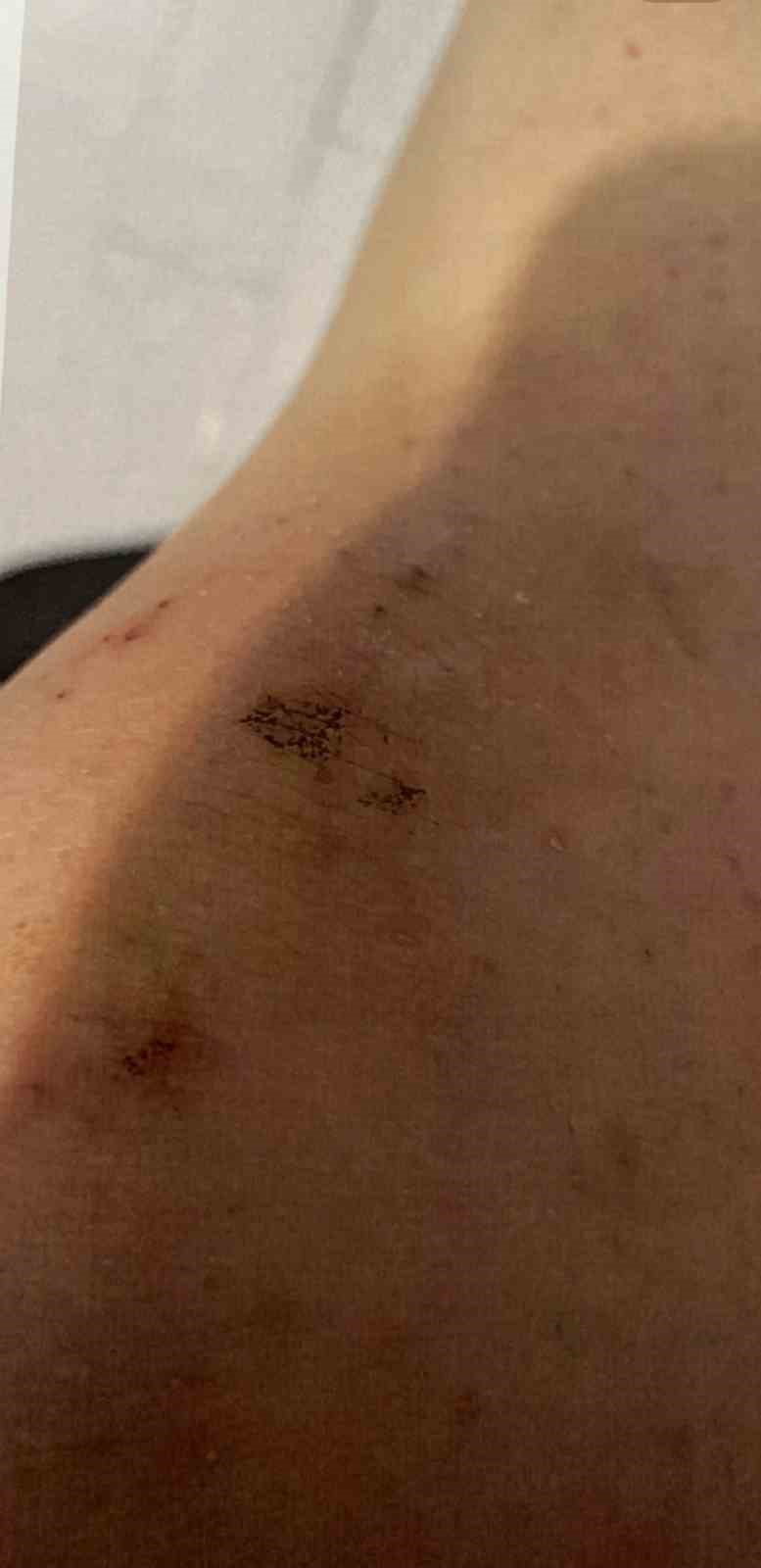 Polis memuru sevgilisi tarafından darp edilen kadın: "Can g&uuml;venliğim yok"
