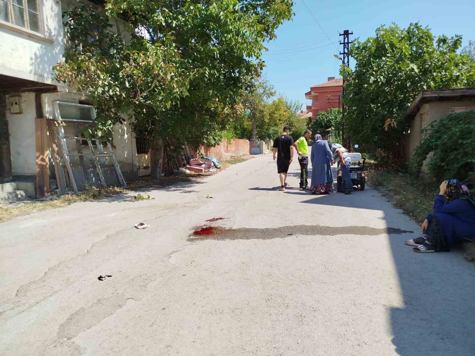 Çorum’da elektrikli motosiklet kazası: 1 yaralı