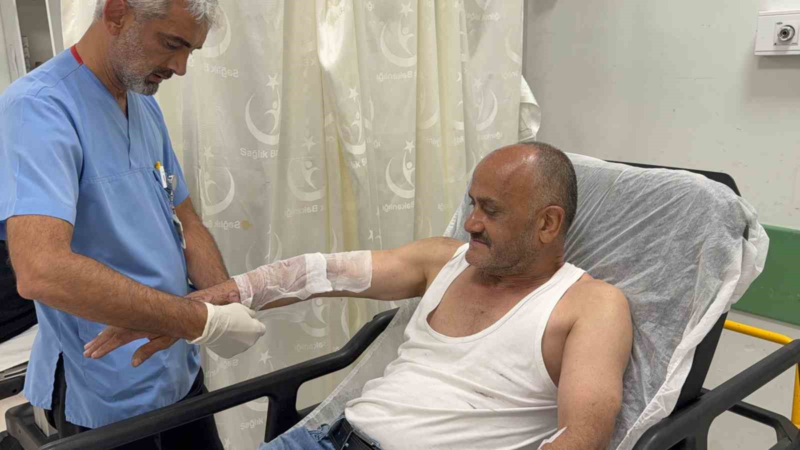 T&uuml;p parlamasıyla alevler i&ccedil;inde kalan şahıs dereye atlayarak yanmaktan kurtuldu
