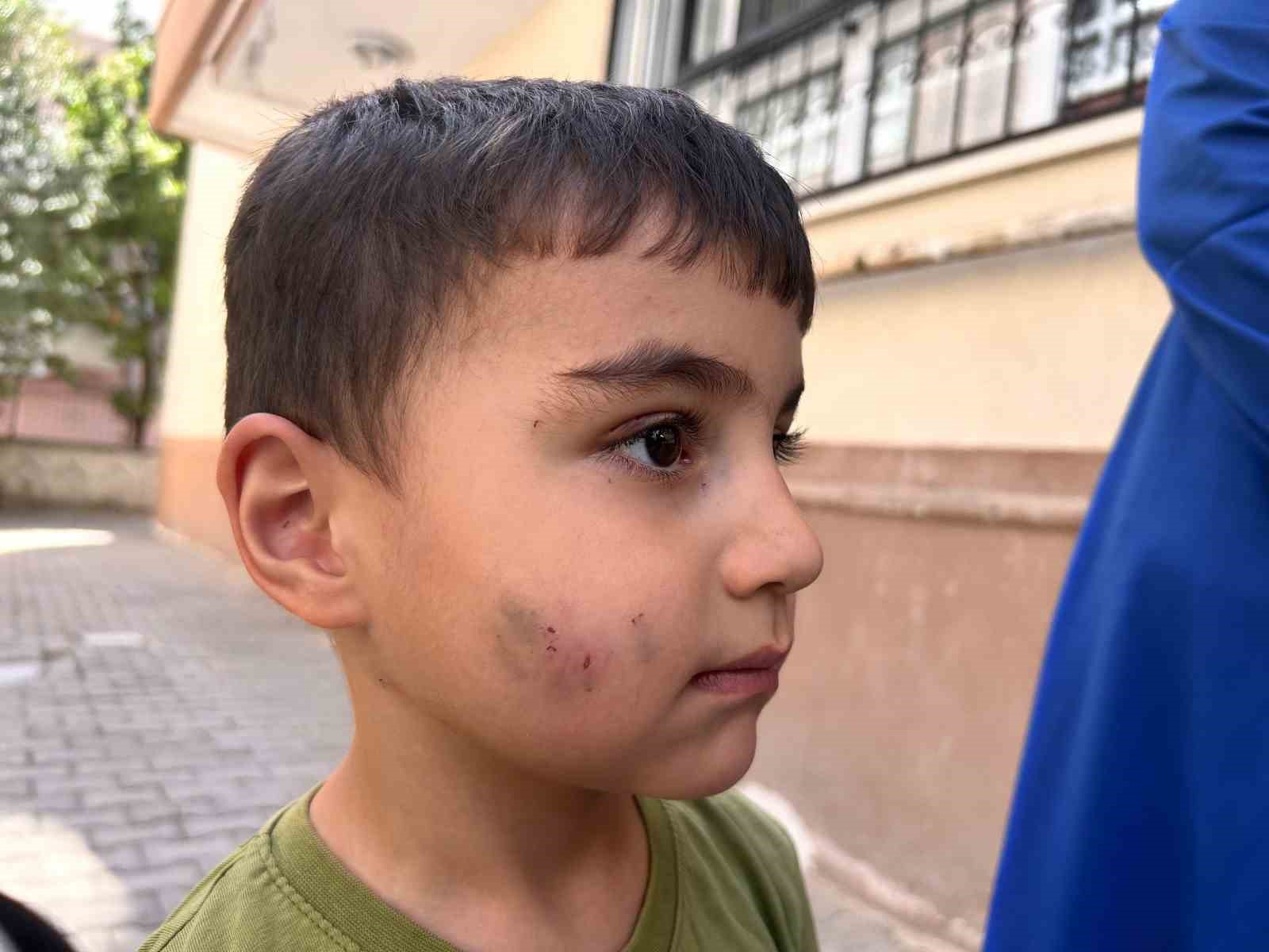 Evde uyuyan çocuğu lağım faresi ısırdı