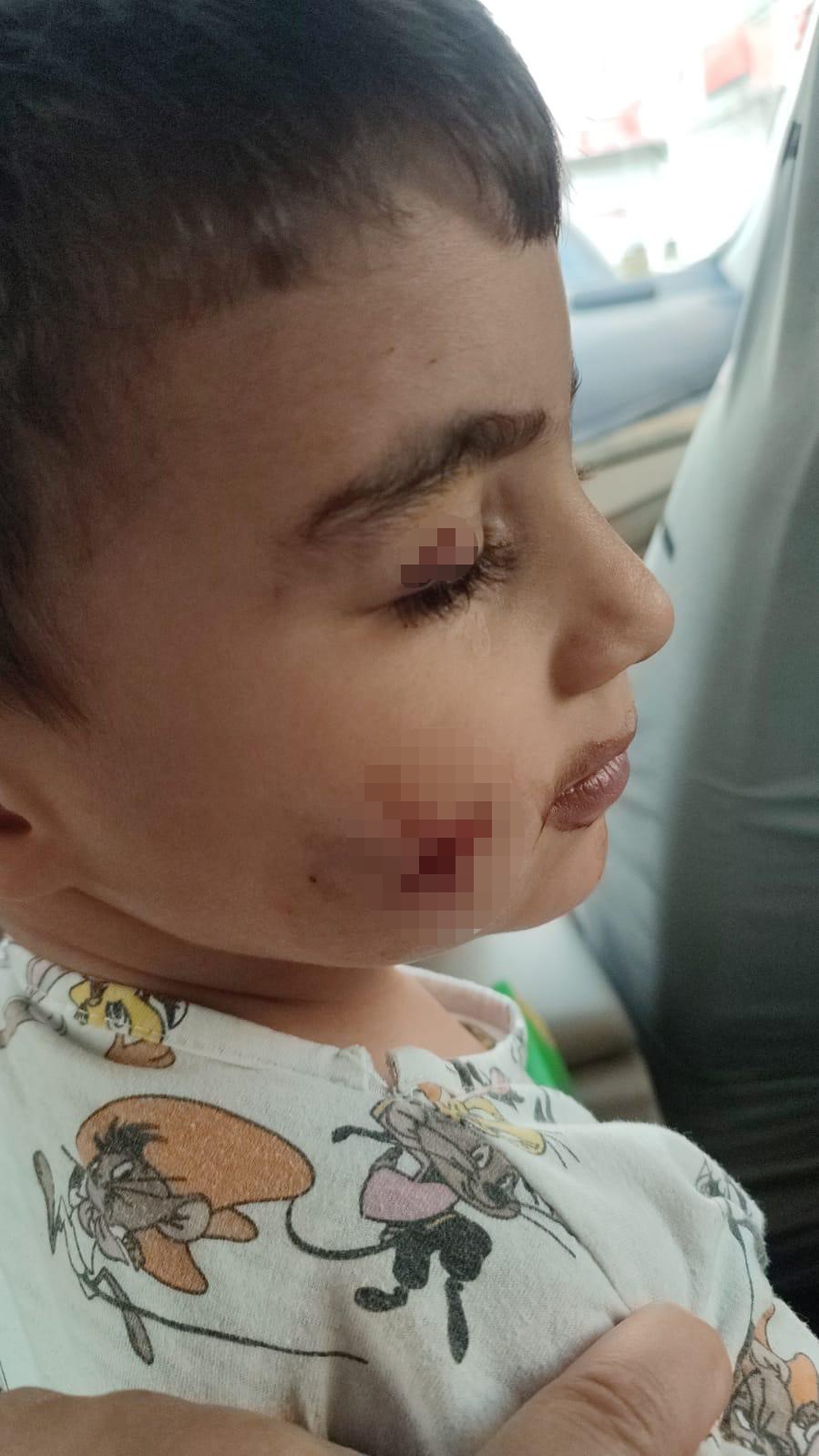 Evde uyuyan &ccedil;ocuğu lağım faresi ısırdı
