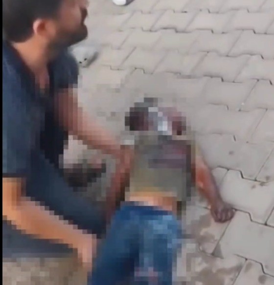 Yangında ağır yaralanan çocuk hayatını kaybetti