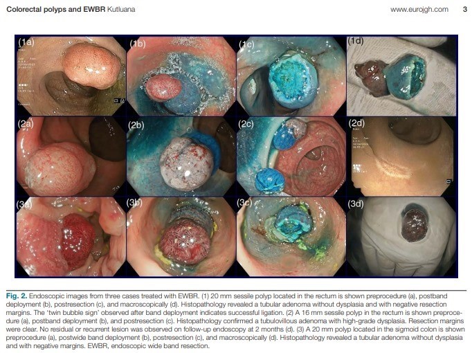 Türk bilim adamının yeni yöntemi uluslararası tıp camiasında kabul gördü