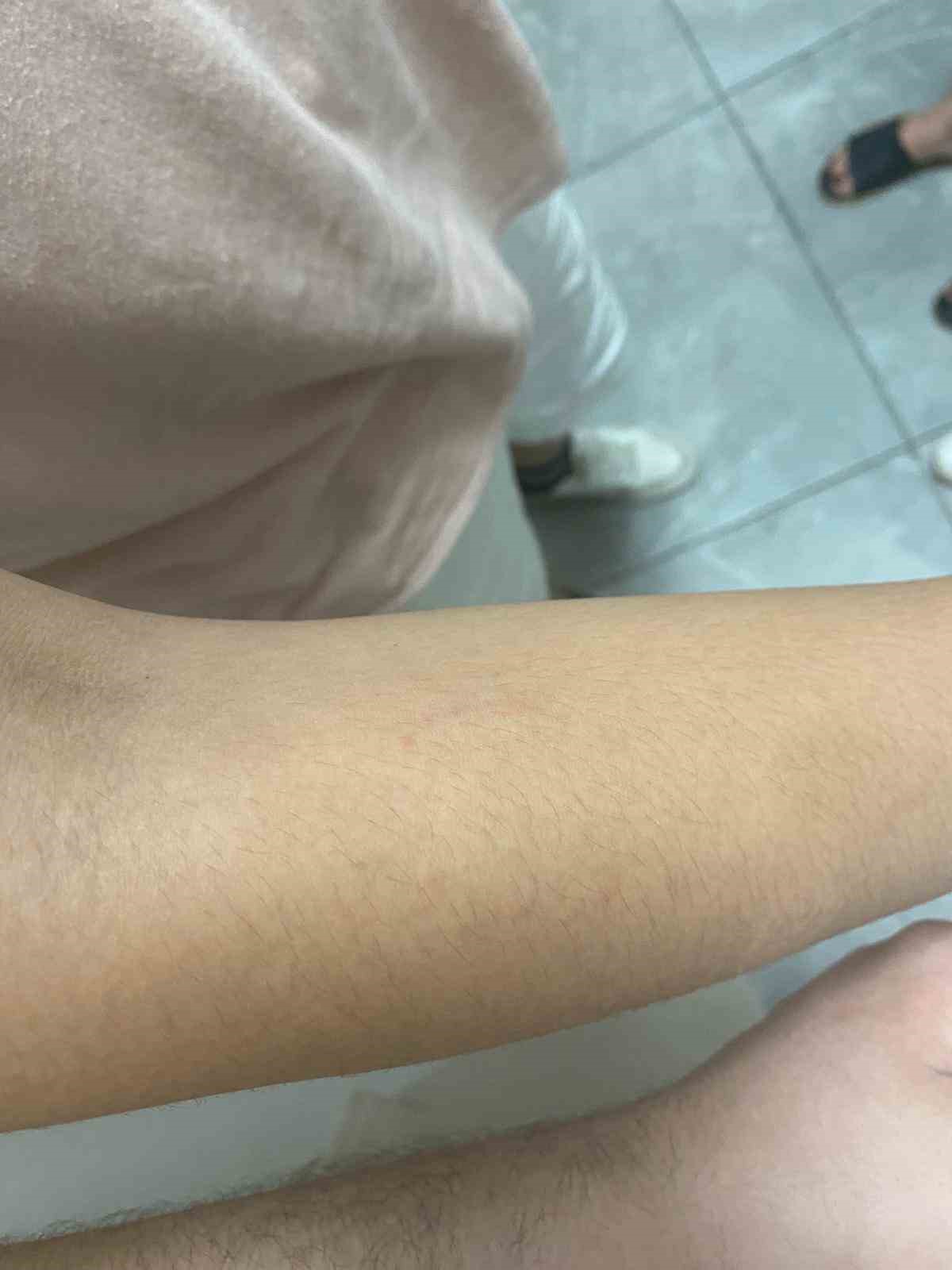 Isırılıp darbedilen çocuğun annesi yaşananları anlattı