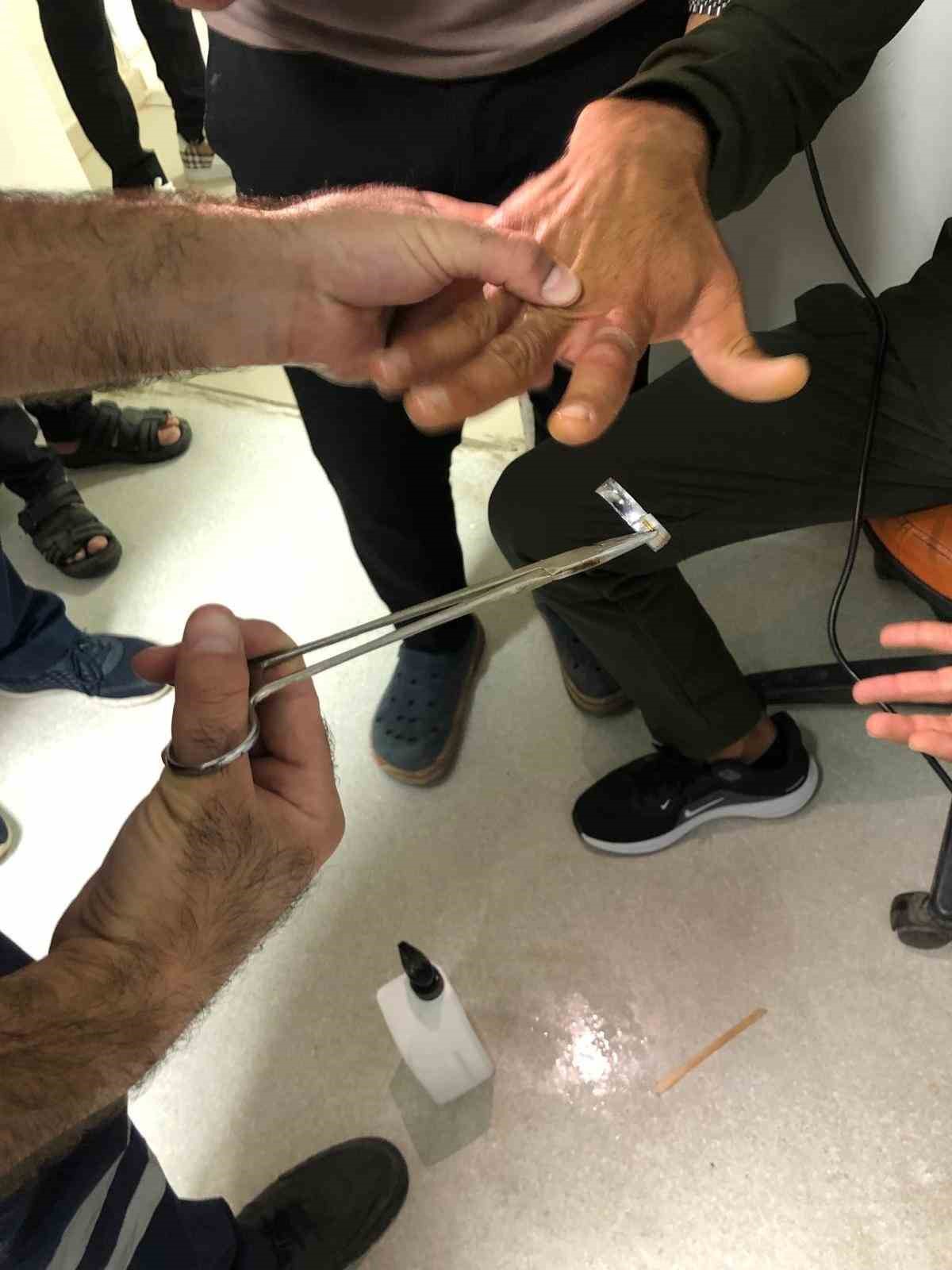 Mardin&rsquo;de bir kişinin parmağında sıkışan y&uuml;z&uuml;k itfaiye ekiplerince &ccedil;ıkartıldı
