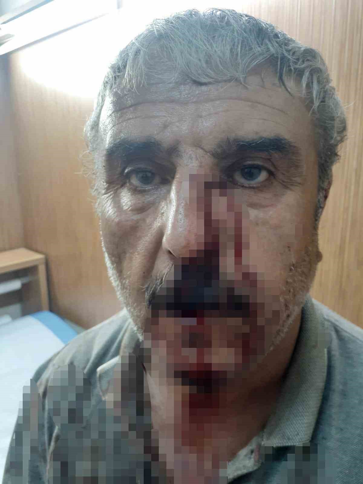 Doktor ile emekli &ouml;ğretmenin mesai kavgası karakolda bitti
