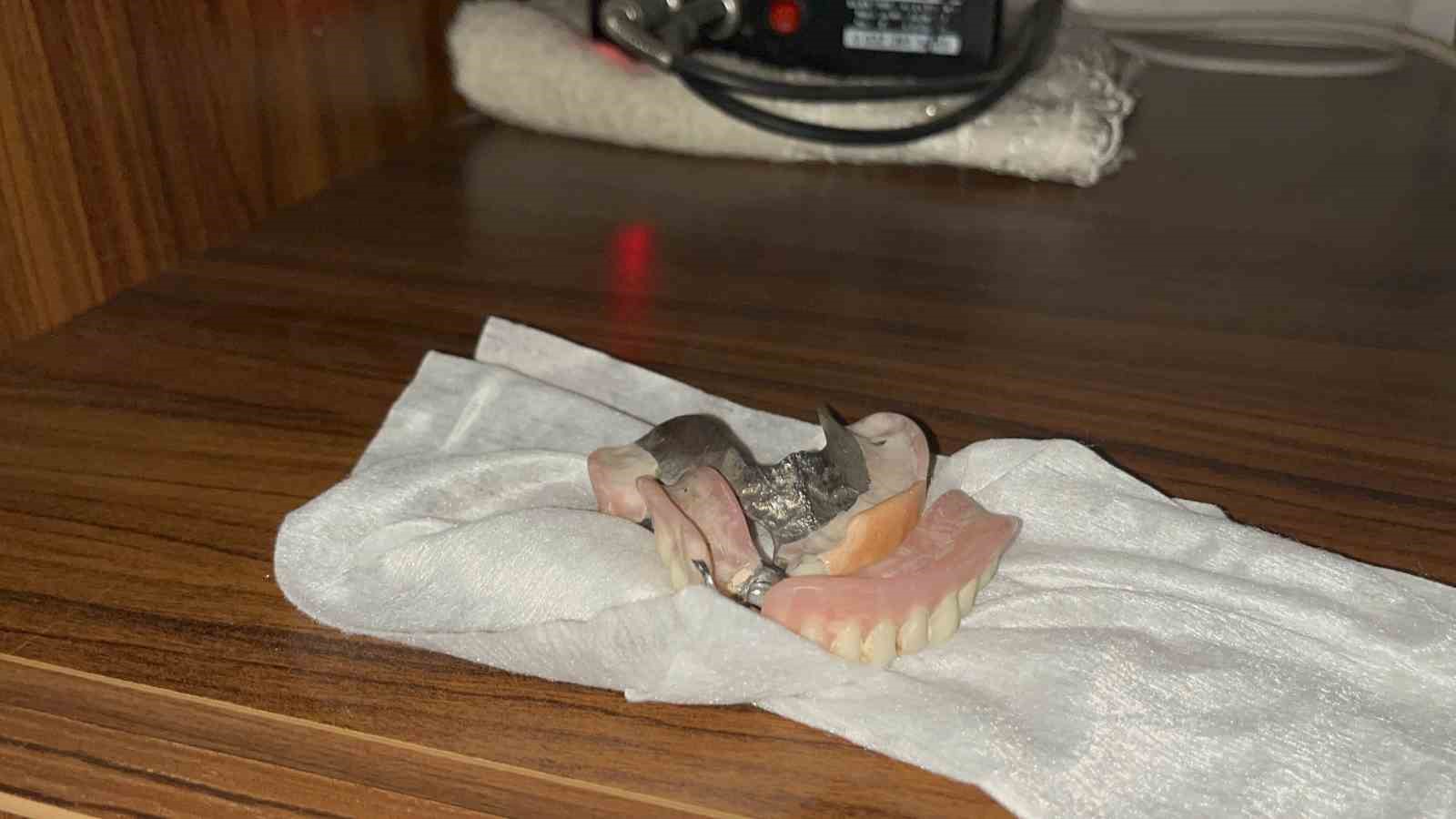 Camide unutulan dişlerin sahibi her yerde aranıyor 