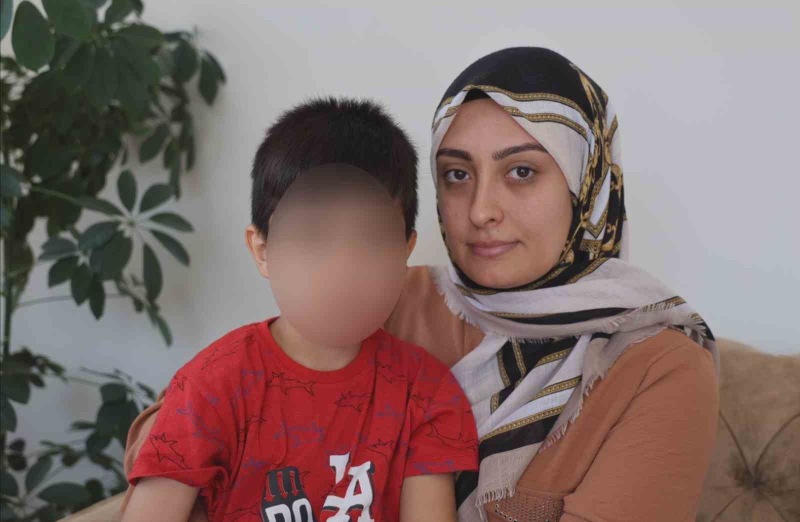 Nevşehir’de 5 yaşındaki çocuğun ameliyatta dili ve dudağı yandı