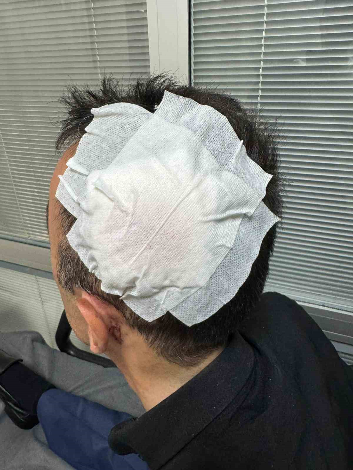 Bayburt&rsquo;ta ehliyetsiz s&uuml;r&uuml;c&uuml; engelli vatandaşa &ccedil;arpıp ka&ccedil;tı: "Sadece ben değil, insanlık ve vicdan da yaralandı"
