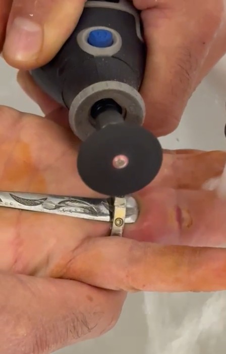 Parmağına yüzük sıkışan kadının yardımına itfaiye yetişti