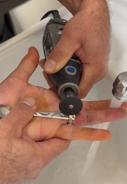 Parmağına yüzük sıkışan kadının yardımına itfaiye yetişti