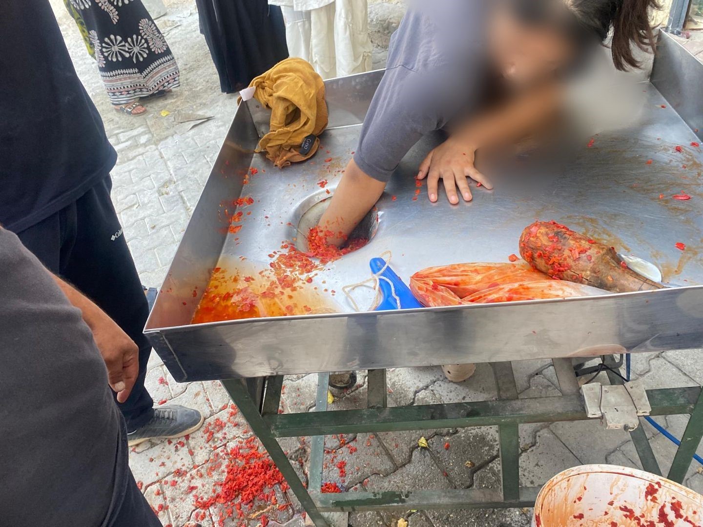 Kız çocuğu elini salça makinesine kaptırdı