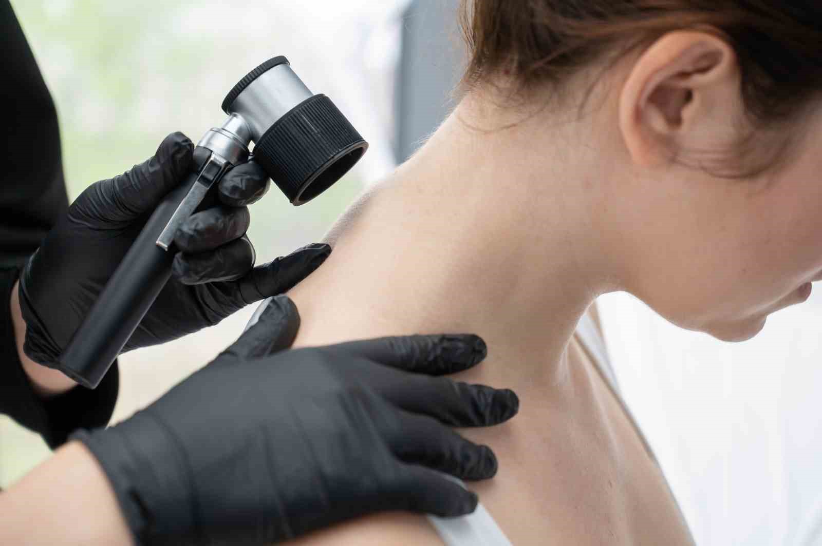 Uzm. Dr. Özkapu: "Cilt check-up’ınızı ertelemeyin"
