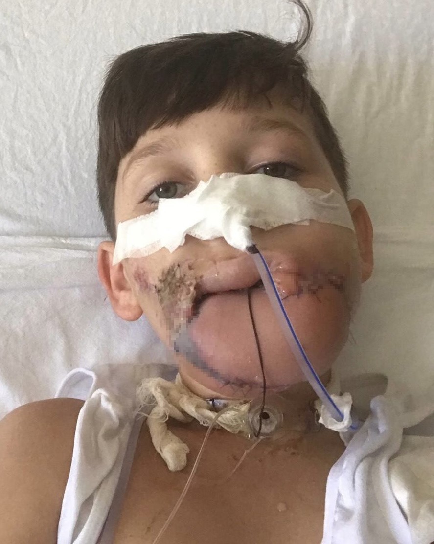 10 yaşındaki &ccedil;ocuk t&uuml;fekle &ccedil;enesinden vuruldu, aile "adalet" arıyor
