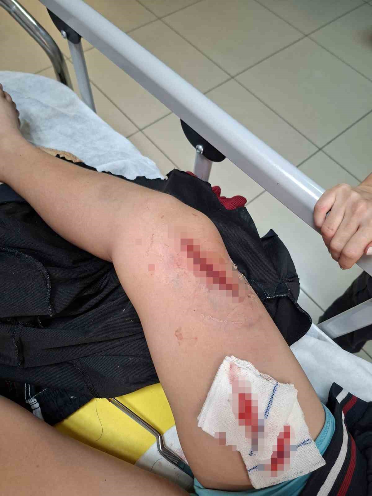 Okul bah&ccedil;esinde bayrak direği &ouml;ğrencilerin &uuml;zerine devrildi: 1 &ccedil;ocuk yaralandı
