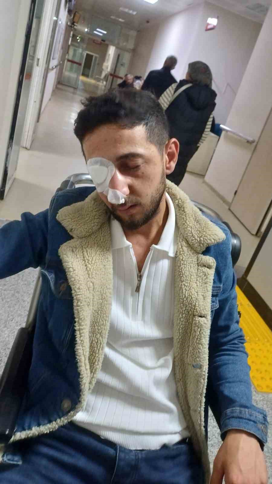 D&uuml;ğ&uuml;n eğlencesi kabusa d&ouml;nd&uuml;: Sağ g&ouml;z&uuml;nden oldu
