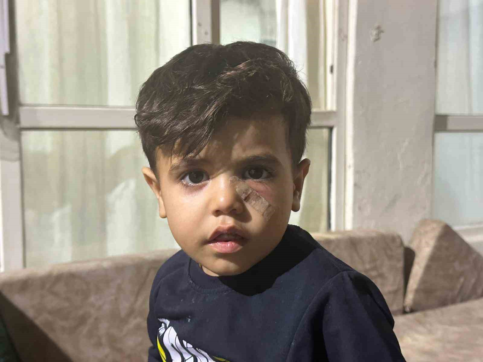 Yorgun merminin isabet ettiği &ccedil;ocuk yaralandı
