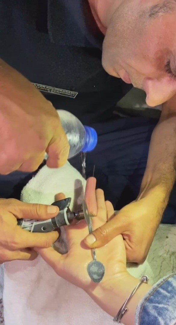 Parmağına yüzük sıkışan vatandaşın imdadına itfaiye ekipleri yetişti