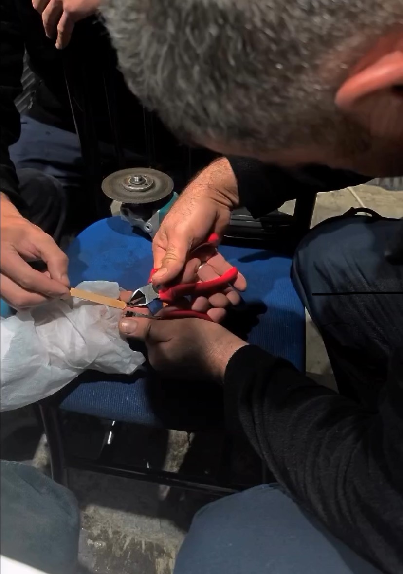 Vatandaşın parmağına yüzük sıkışan yüzüğü itfaiye çıkardı