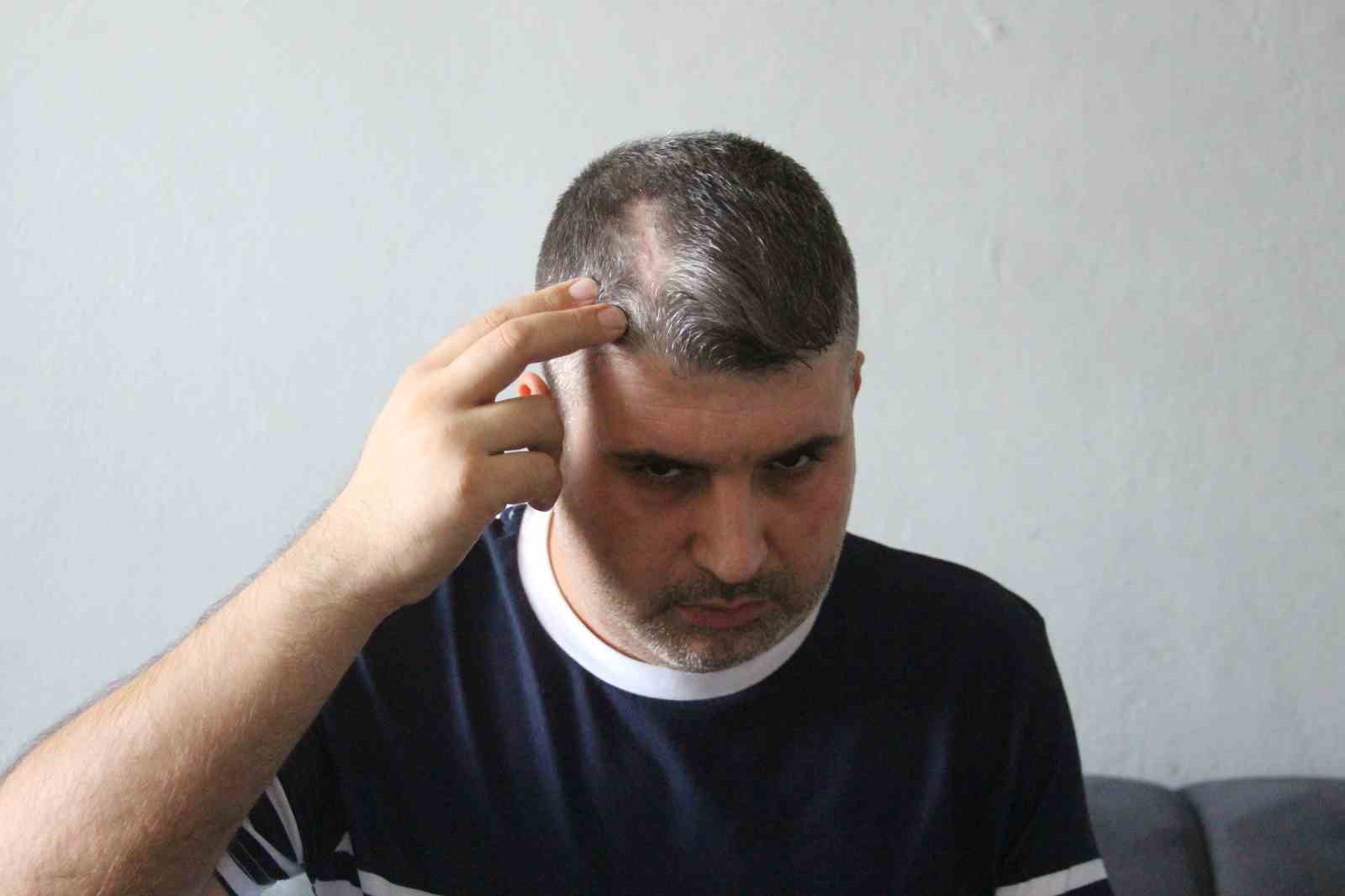 Beyzbol sopalı saldırgan dayı serbest kalınca yeğeni yardım istedi: "Can güvenliğim yok"