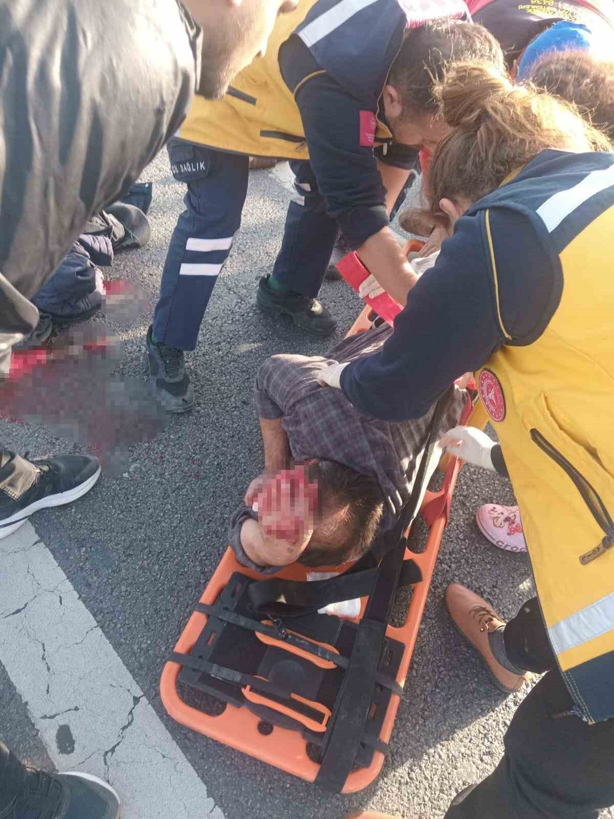 K&ouml;peğe &ccedil;arpmamak i&ccedil;in manevra yapınca bariyerlere &ccedil;arpıp yaralandı
