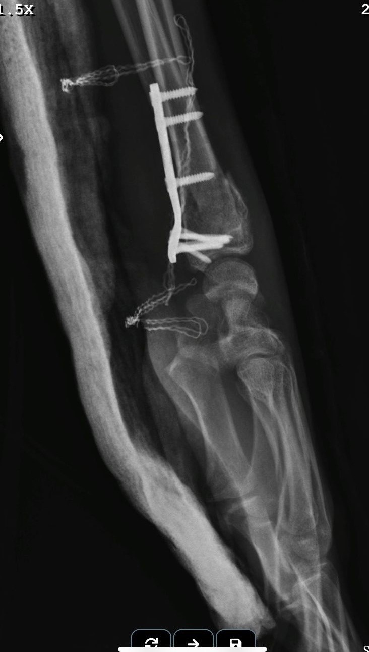 Feci kazada ağır yaralanan motosiklet sürücüsünün babası konuştu