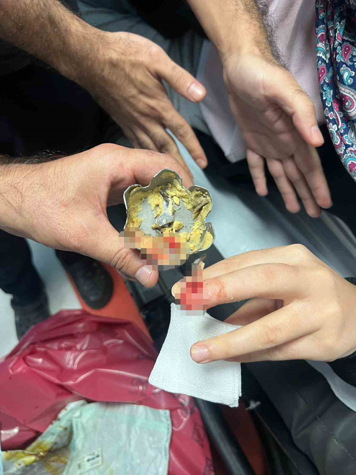 Batman&rsquo;da yemek hazırlayan kadının parmağına blender par&ccedil;ası battı
